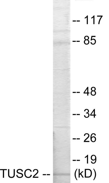 TUSC2 Colorimetric Cell-Based ELISA (CBCAB00956)