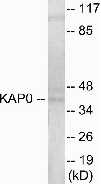 KAP0 Colorimetric Cell-Based ELISA (CBCAB00974)