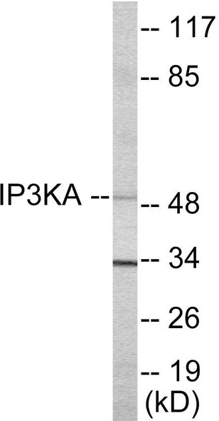 IP3KA Colorimetric Cell-Based ELISA (CBCAB00990)