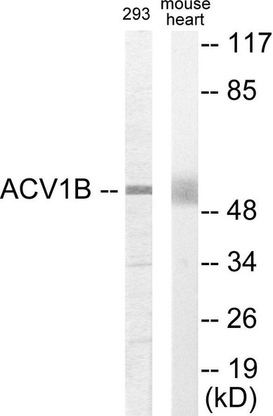 ACV1B Colorimetric Cell-Based ELISA (CBCAB01008)