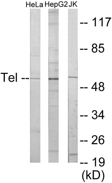 ETV6 Colorimetric Cell-Based ELISA (CBCAB01009)