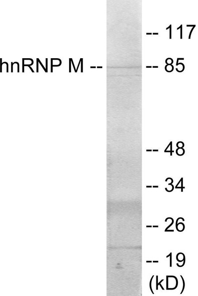 hnRNP M Colorimetric Cell-Based ELISA (CBCAB01029)