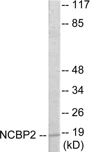 NCBP2 Colorimetric Cell-Based ELISA (CBCAB01030)