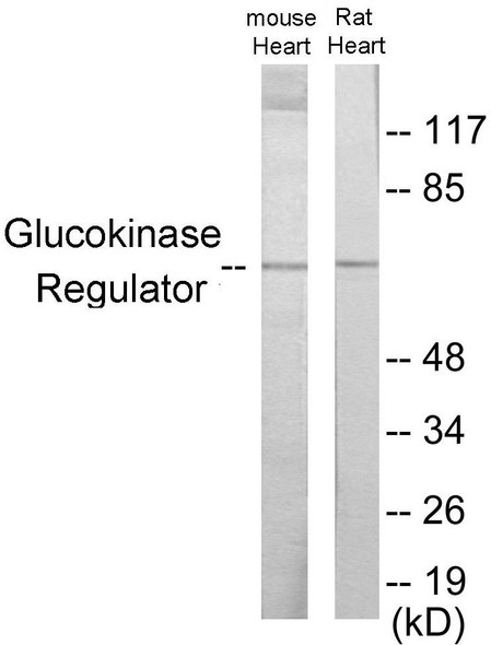 Glucokinase Regulator Colorimetric Cell-Based ELISA (CBCAB01096)