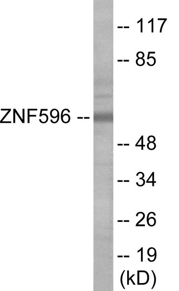 ZNF596 Colorimetric Cell-Based ELISA (CBCAB01161)