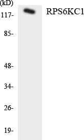RPS6KC1 Colorimetric Cell-Based ELISA (CBCAB01183)