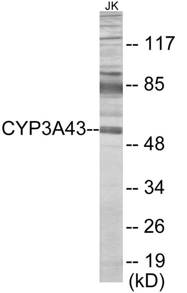 Cytochrome P450 3A43 Colorimetric Cell-Based ELISA (CBCAB01196)