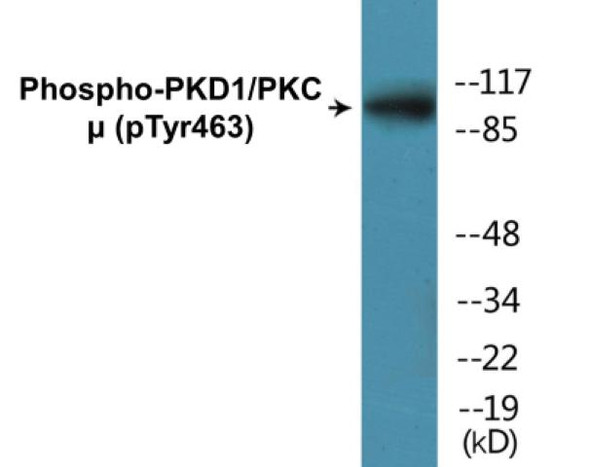 PKD1/PKC mu (Phospho-Tyr463)Colorimetric Cell-Based ELISA Kit (CBCAB01380)