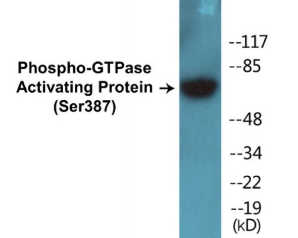 GTPase Activating Protein (Phospho-Ser387)Colorimetric Cell-Based ELISA Kit (CBCAB01447)