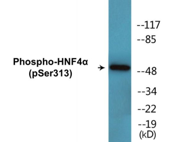HNF4alpha (Phospho-Ser313)Colorimetric Cell-Based ELISA Kit (CBCAB01544)