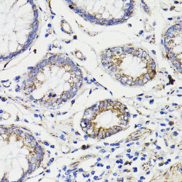 Caspase-8 Rabbit Polyclonal Antibody (CAB0215)