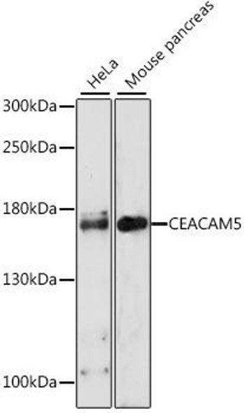 CEACAM5 Rabbit Polyclonal Antibody (CAB0970)