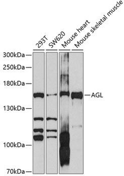 AGL Rabbit Polyclonal Antibody (CAB10051)