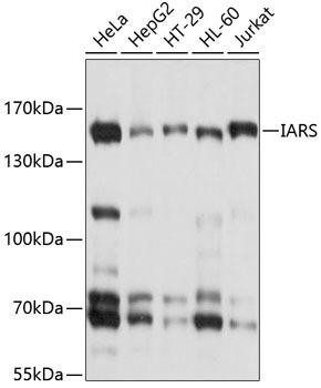 IARS Rabbit Polyclonal Antibody (CAB10190)