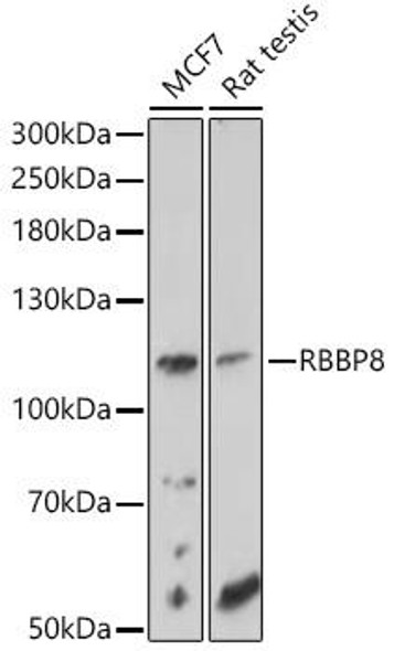 RBBP8 Rabbit Polyclonal Antibody (CAB10201)