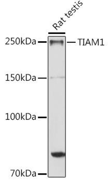 TIAM1 Rabbit Polyclonal Antibody (CAB10252)