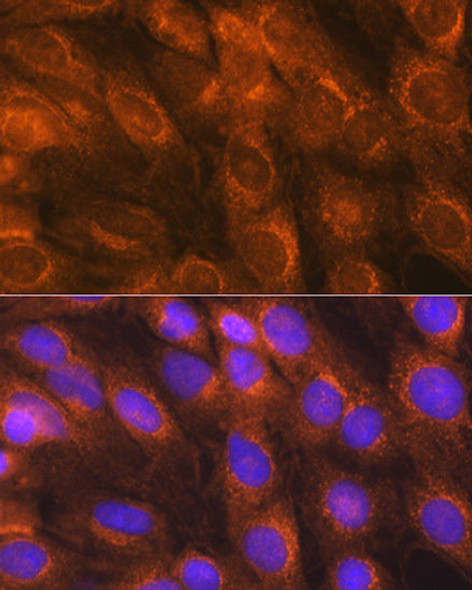 LMAN1 Rabbit Polyclonal Antibody (CAB10440)