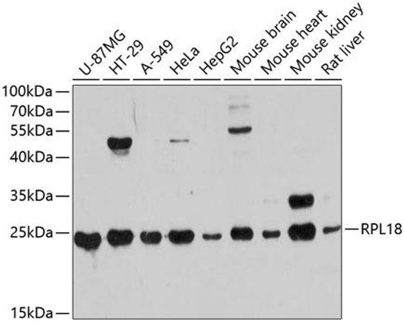 RPL18 Rabbit Polyclonal Antibody (CAB10720)