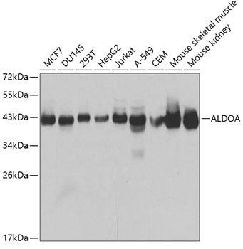 ALDOA Rabbit Polyclonal Antibody (CAB1142)