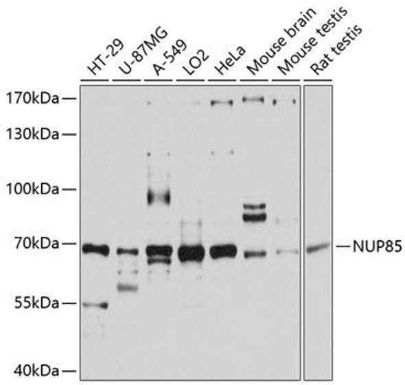 NUP85 Rabbit Polyclonal Antibody (CAB11629)