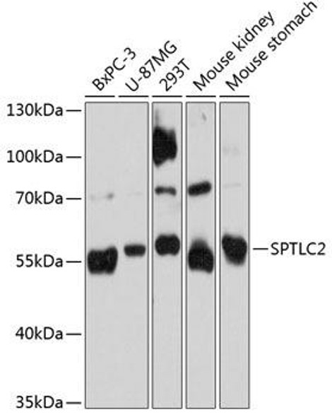 SPTLC2 Rabbit Polyclonal Antibody (CAB11716)