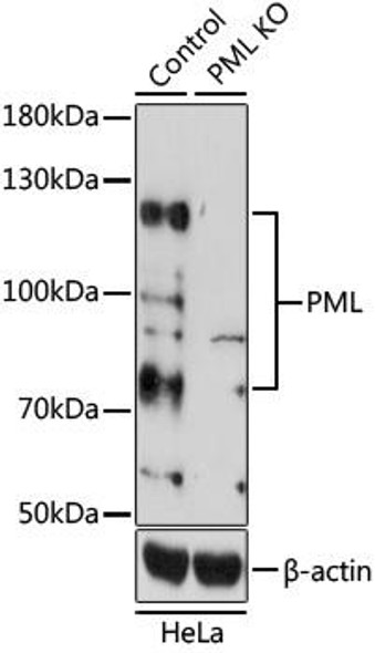 [KO Validated] PML Rabbit Polyclonal Antibody (CAB1184)