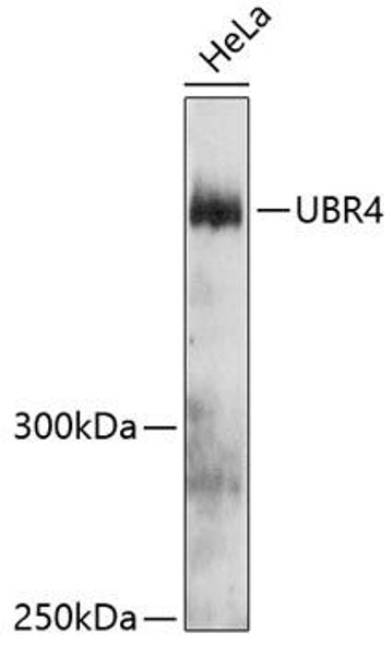 UBR4 Rabbit Polyclonal Antibody (CAB12193)