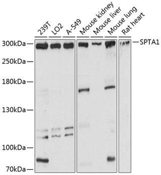 alpha 1 Spectrin Rabbit Polyclonal Antibody (CAB12355)