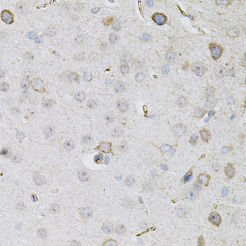 CEACAM5 Rabbit Polyclonal Antibody (CAB12421)