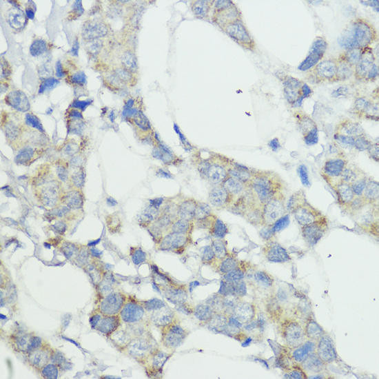 NOD1 Rabbit Polyclonal Antibody (CAB1246)