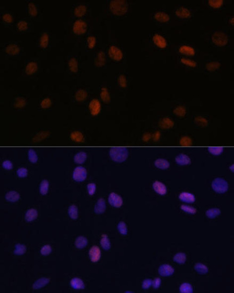PSME3 Rabbit Polyclonal Antibody (CAB12697)