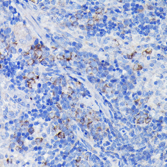 CLU Rabbit Polyclonal Antibody (CAB12913)