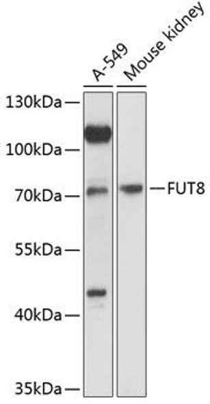 FUT8 Rabbit Polyclonal Antibody (CAB12933)