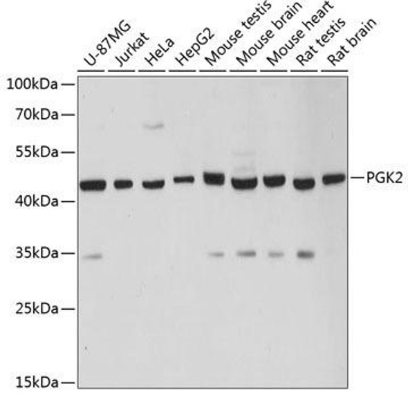 PGK2 Rabbit Polyclonal Antibody (CAB12952)