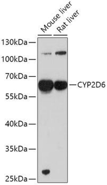 CYP2D6 Rabbit Polyclonal Antibody (CAB1299)
