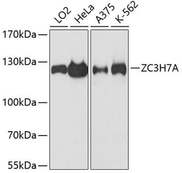 ZC3H7A Rabbit Polyclonal Antibody (CAB13190)