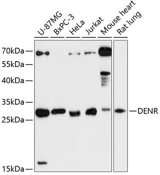 DENR Rabbit Polyclonal Antibody (CAB13699)