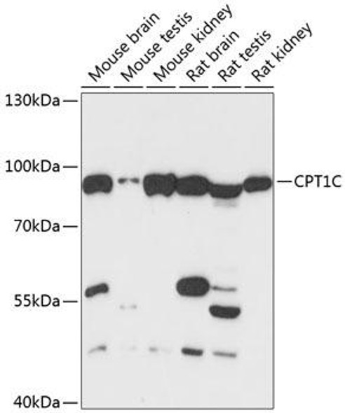 CPT1C Rabbit Polyclonal Antibody (CAB13849)