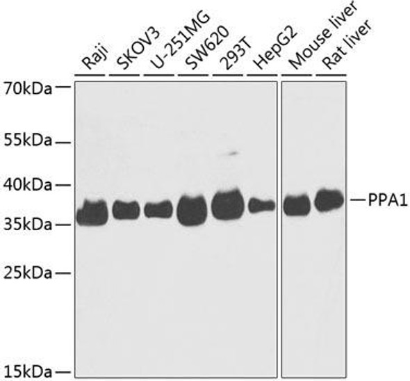PPA1 Rabbit Polyclonal Antibody (CAB14050)