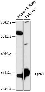 QPRT Rabbit Polyclonal Antibody (CAB14349)