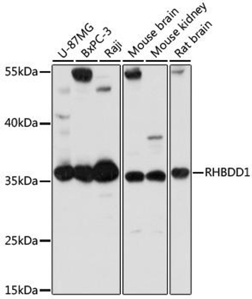 RHBDD1 Rabbit Polyclonal Antibody (CAB14350)