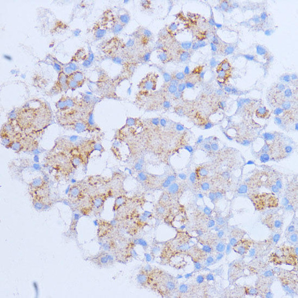 NME6 Rabbit Polyclonal Antibody (CAB14388)