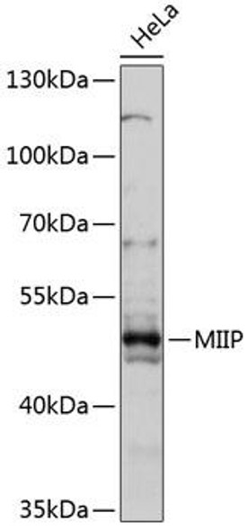 MIIP Rabbit Polyclonal Antibody (CAB14417)
