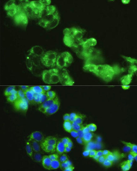 GOLGA1 Rabbit Polyclonal Antibody (CAB14688)