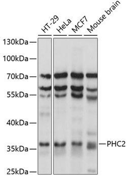 PHC2 Rabbit Polyclonal Antibody (CAB14727)