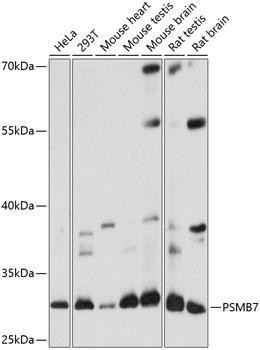 PSMB7 Rabbit Polyclonal Antibody (CAB14771)