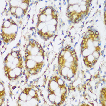 ERLIN1 Rabbit Polyclonal Antibody (CAB14843)