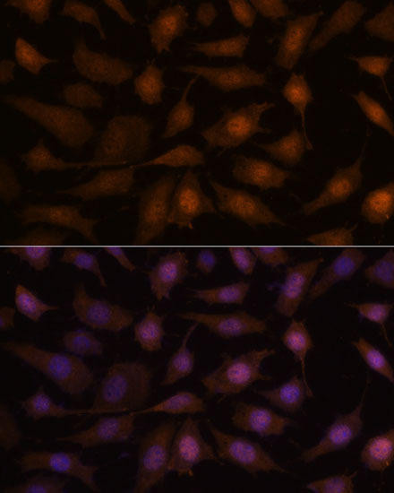 EEF1E1 Rabbit Polyclonal Antibody (CAB15357)