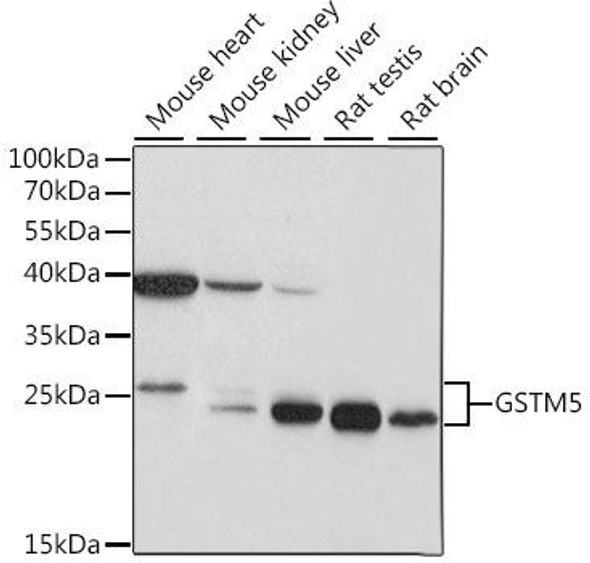 GSTM5 Rabbit Polyclonal Antibody (CAB15677)