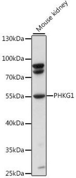 PHKG1 Rabbit Polyclonal Antibody (CAB15701)